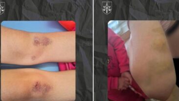 В Полтавській області опікунку підозрюють у тортурах над дітьми