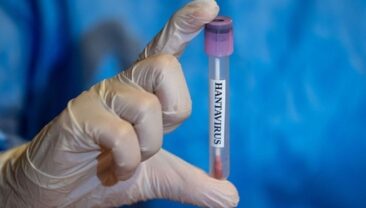 У Львівській області зафіксовано випадок хантавирусної інфекції