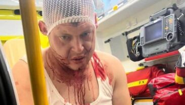 Нападіння на українців у Кожухові через музику